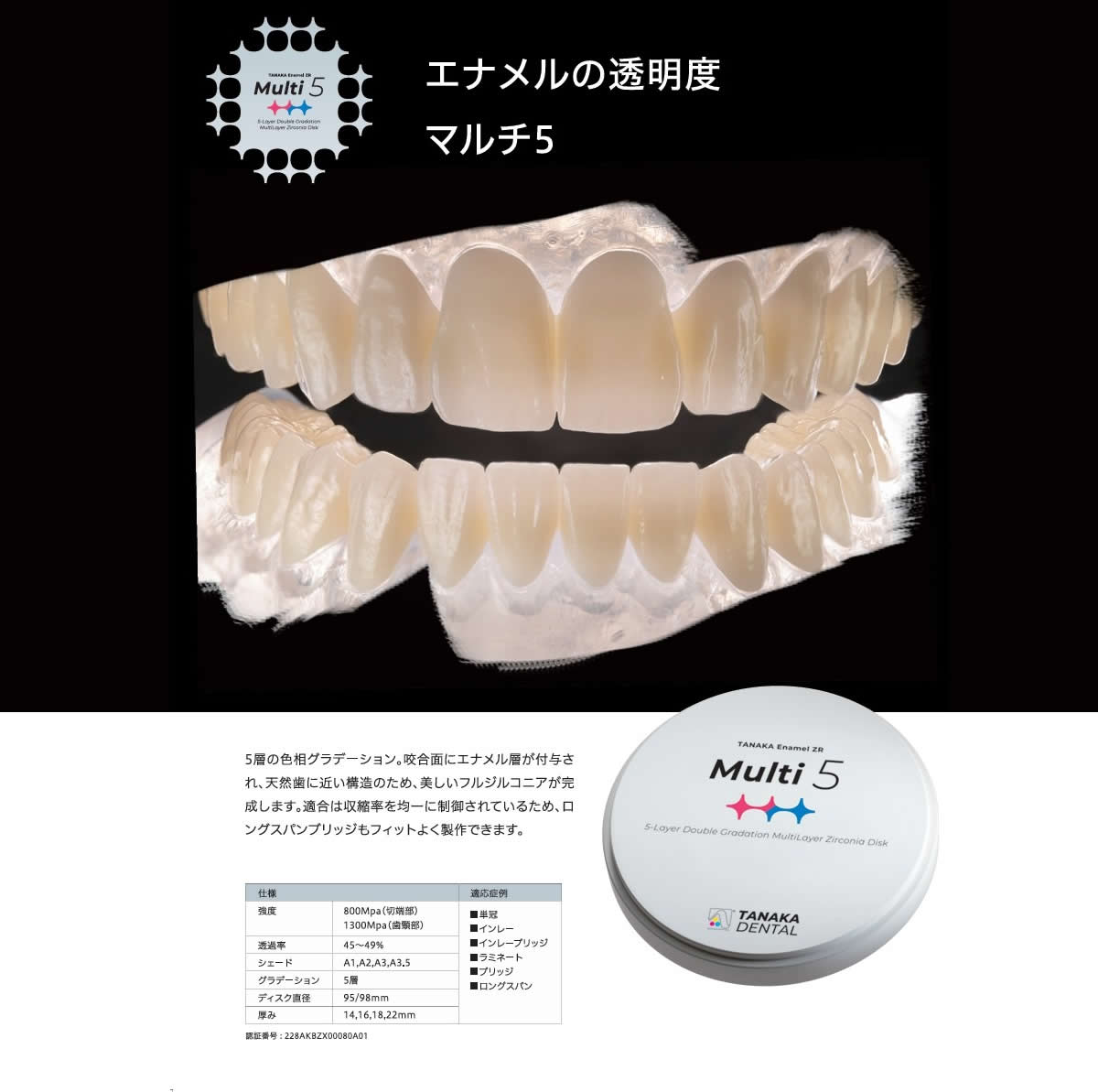 マルチレイヤーフルジルコニア