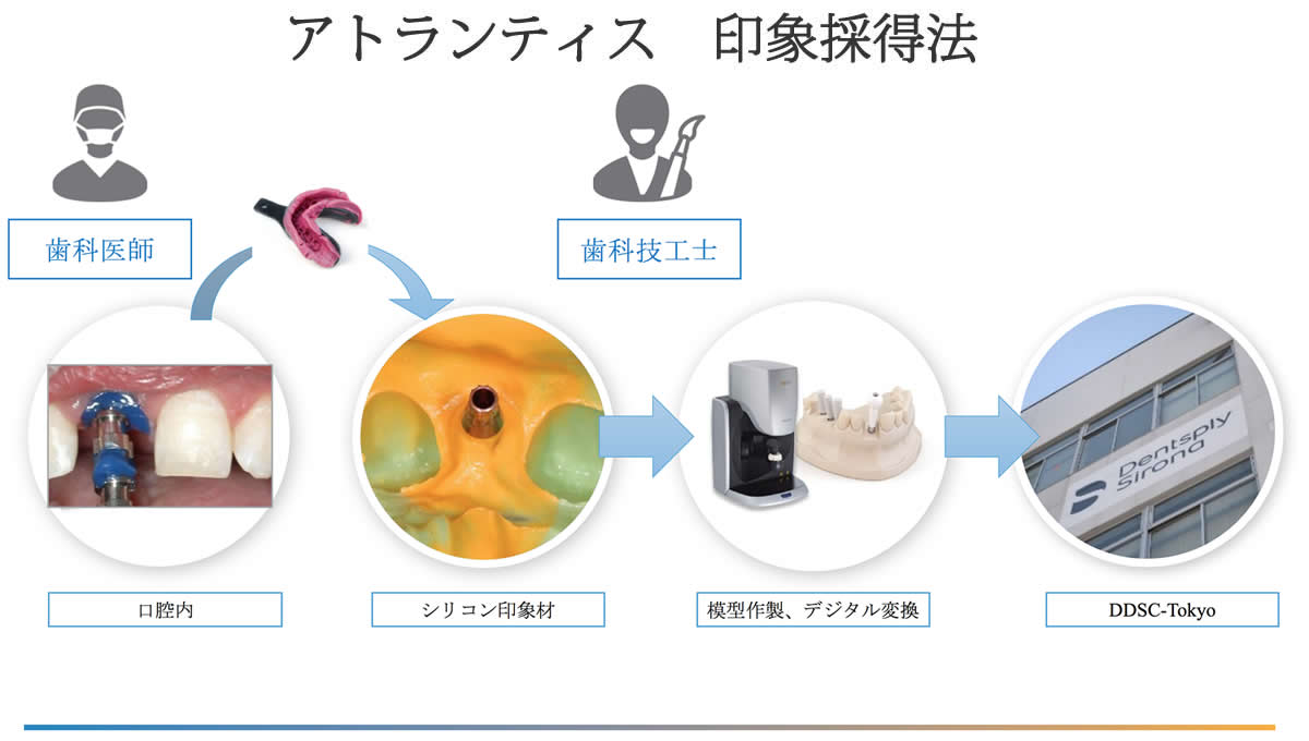 デジタルインプラント