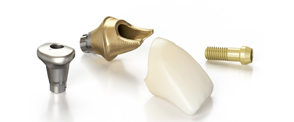 デジタルアバットメント