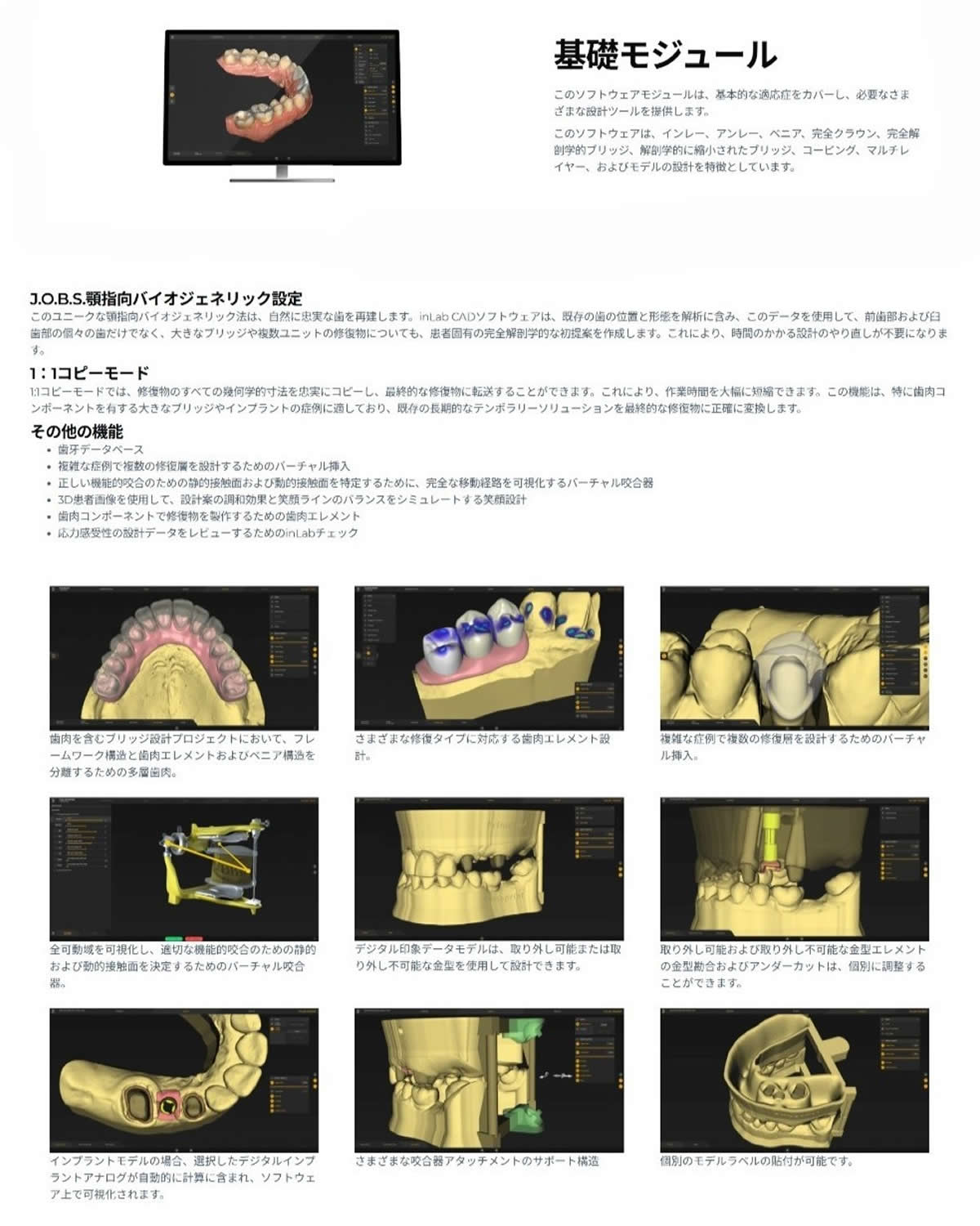 inLab CADソフトウェア
