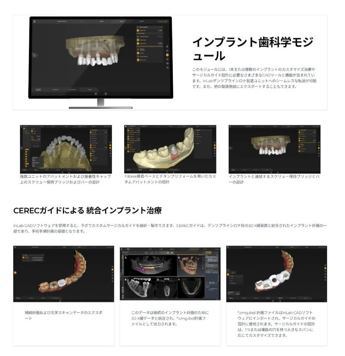 inLab CADソフトウェア